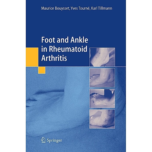Foot and ankle in rheumatoid arthritis, Maurice Bouysset, Yves Tourné, Karl Tillmann