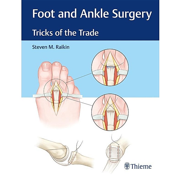 Foot and Ankle Surgery, Steven M. Raikin