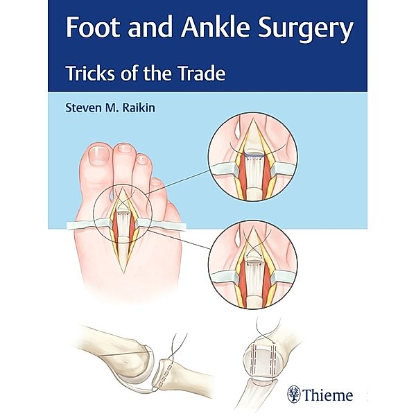 Foot and Ankle Surgery, Steven M. Raikin