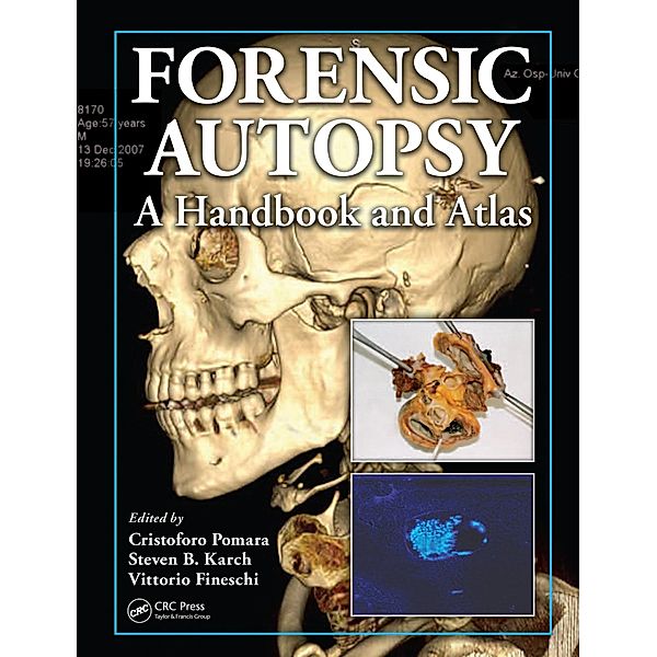 Forensic Autopsy