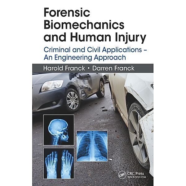 Forensic Biomechanics and Human Injury, Harold Franck, Darren Franck