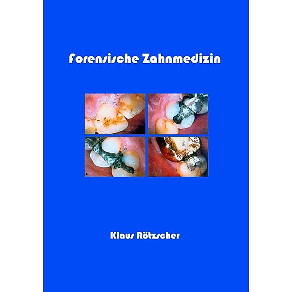 Forensische Zahnmedizin