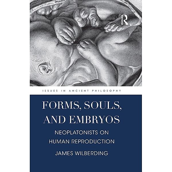 Forms, Souls, and Embryos, James Wilberding