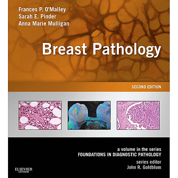 Foundations in Diagnostic Pathology: Breast Pathology E-Book, Frances P. O'Malley, Anne Marie Mulligan, Sarah E Pinder