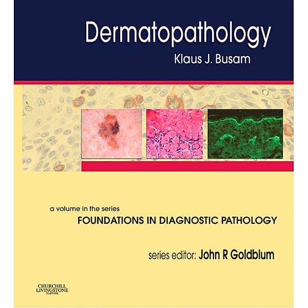 Foundations in Diagnostic Pathology: Dermatopathology E-Book, Klaus J. Busam