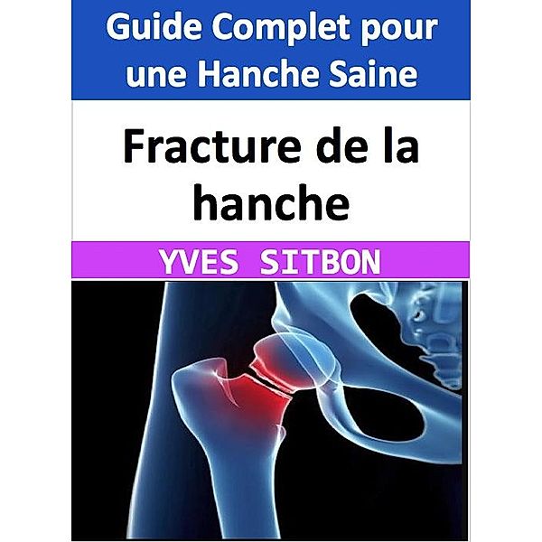 Fracture de la hanche : Guide Complet pour une Hanche Saine, Yves Sitbon