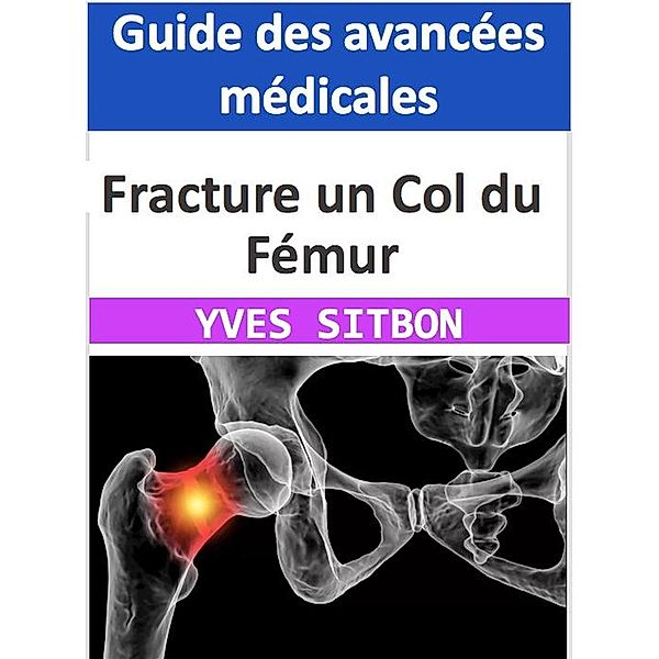 Fracture un Col du Fémur : Guide des avancées médicales, Yves Sitbon