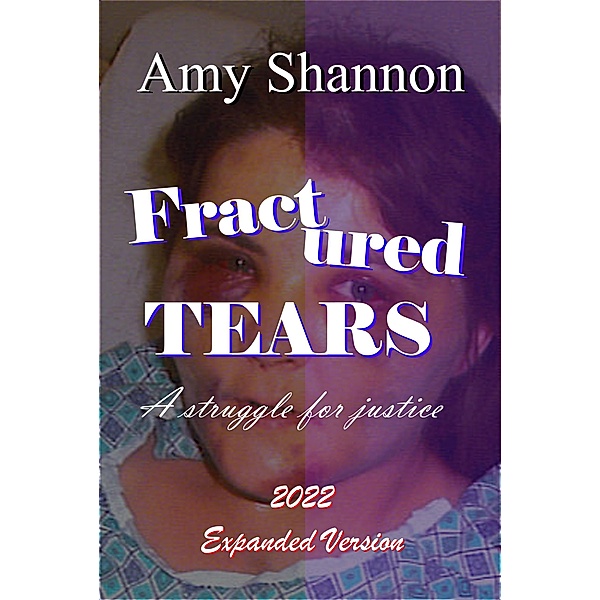 Fractured Tears: A Struggle for Justice, Amy Shannon