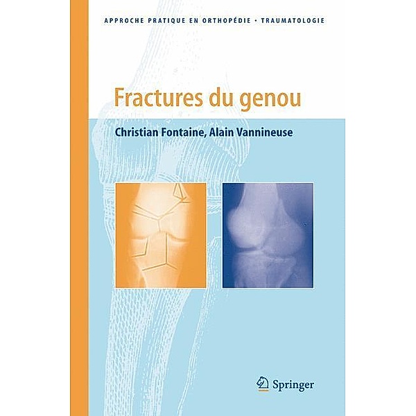Fractures du genou / Approche pratique en orthopédie-traumatologie, Christian Fontaine, Alain Vannineuse