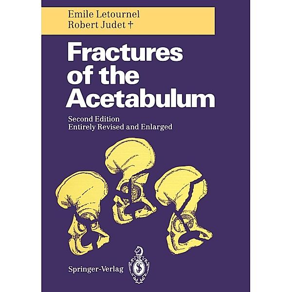 Fractures of the Acetabulum, Emile Letournel, Robert Judet