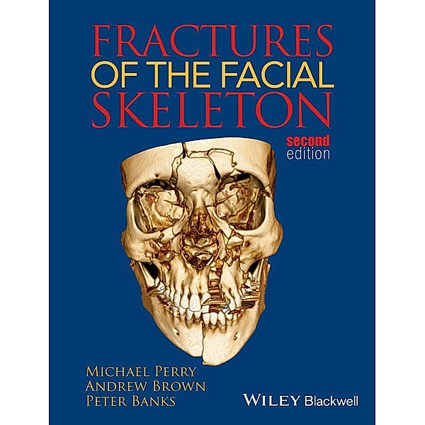 Fractures of the Facial Skeleton, Michael Perry, Andrew K. Brown, Peter Banks