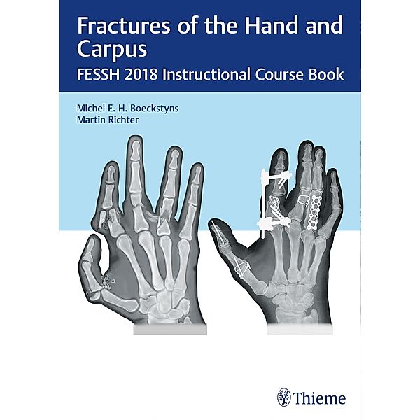 Fractures of the Hand and Carpus