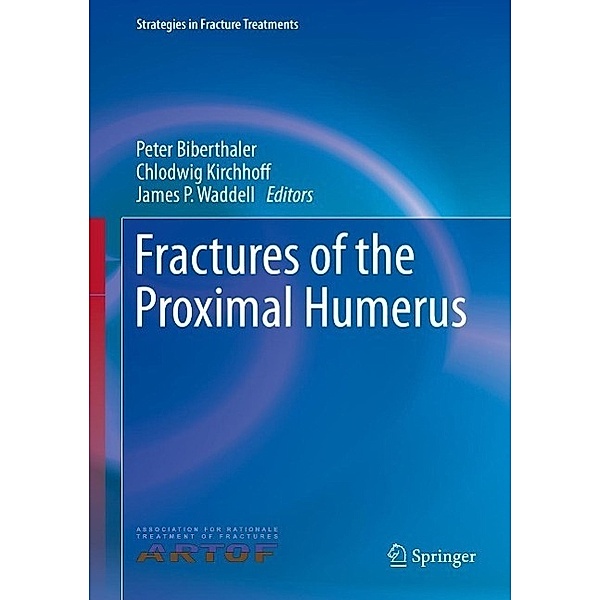 Fractures of the Proximal Humerus / Strategies in Fracture Treatments