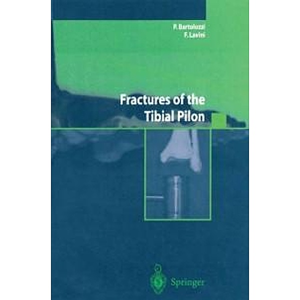 Fractures of the Tibial Pilon, P. Bartolozzi, F. Lavini