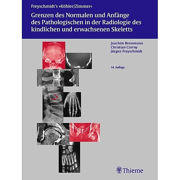 Freyschmidts Köhler/Zimmer: Grenzen des Normalen und Anfänge des Pathologischen, Hermann Schmidt