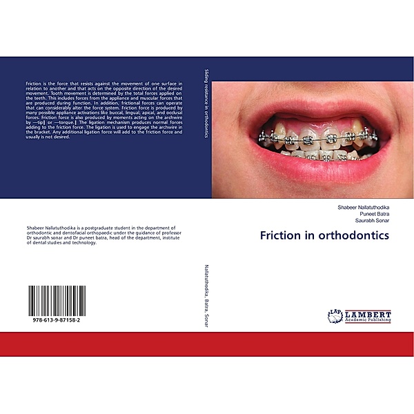 Friction in orthodontics, Shabeer Nallatuthodika, Puneet Batra, Saurabh Sonar