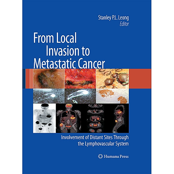 From Local Invasion to Metastatic Cancer