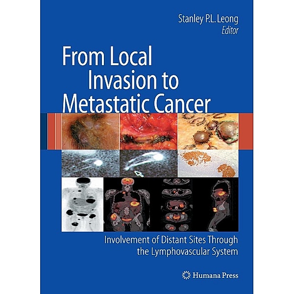 From Local Invasion to Metastatic Cancer / Current Clinical Oncology