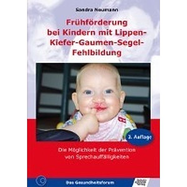 Frühförderung bei Kindern mit Lippen-Kiefer-Gaumen-Segel-Fehlbindung, Sandra Neumann