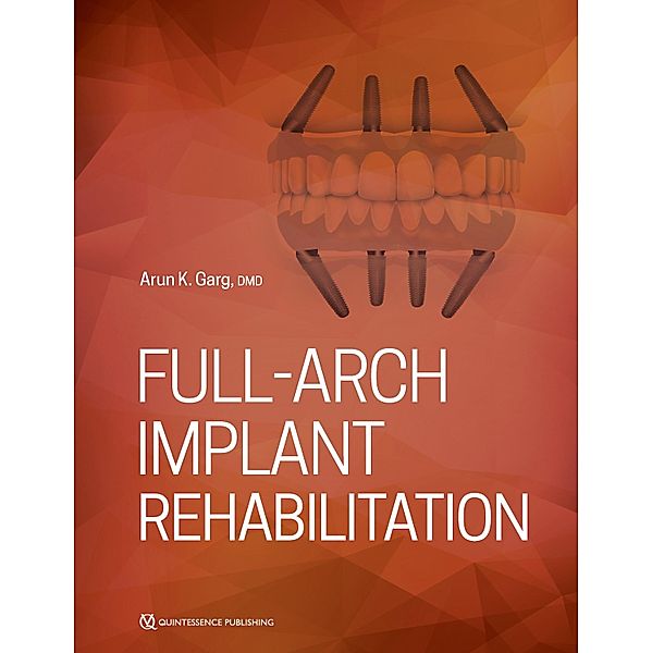 Full-Arch Implant Rehabilitation, Arun Garg