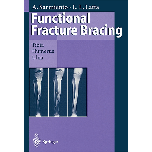 Functional Fracture Bracing, Augusto Sarmiento, Loren L. Latta