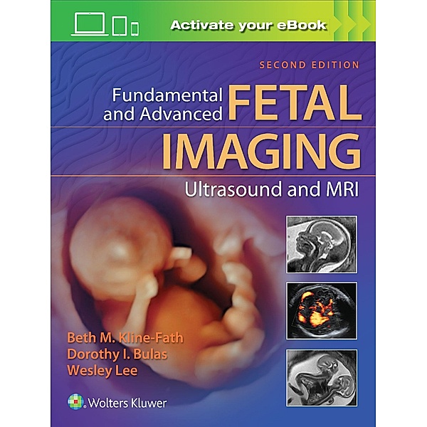 Fundamental and Advanced Fetal Imaging Ultrasound and MRI, Beth Kline-Fath
