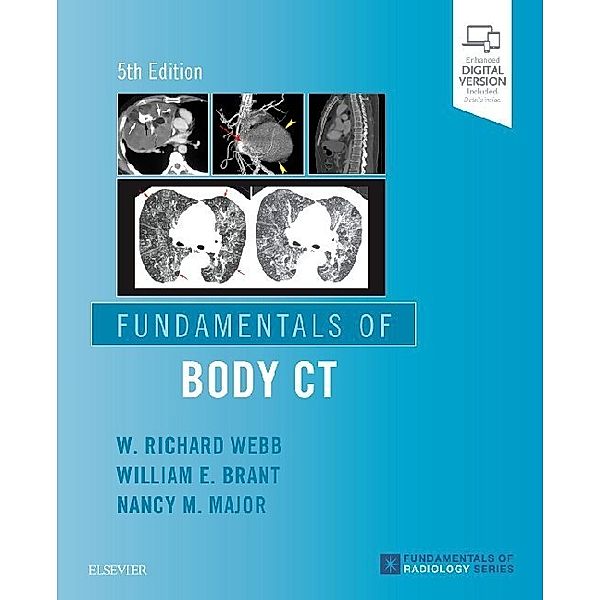 Fundamentals of Body CT, W Richard Webb, Wiliam E. Brant, Nancy M. Major