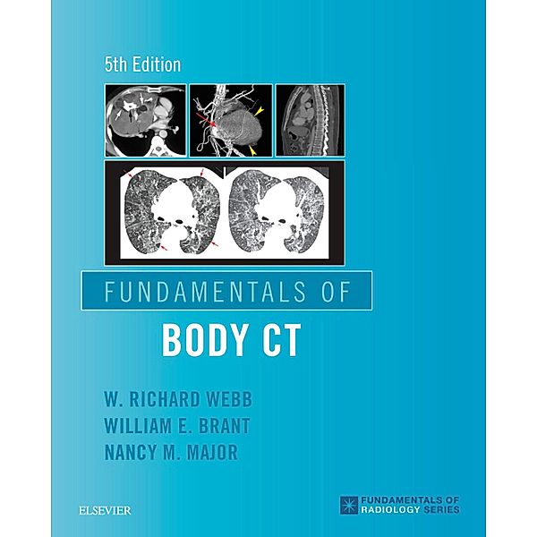 Fundamentals of Body CT E-Book, W. Richard Webb, Wiliam E. Brant, Nancy M. Major