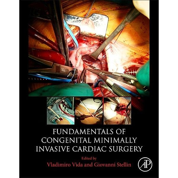 Fundamentals of Congenital Minimally Invasive Cardiac Surgery, Vladimiro Vida, Giovanni Stellin