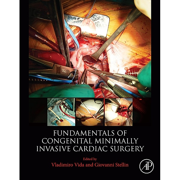 Fundamentals of Congenital Minimally Invasive Cardiac Surgery, Vladimiro Vida, Giovanni Stellin