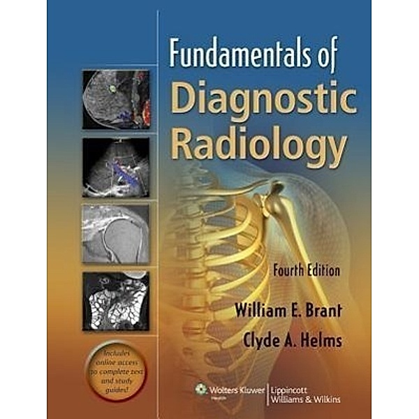 Fundamentals of Diagnostic Radiology, William E. Brant