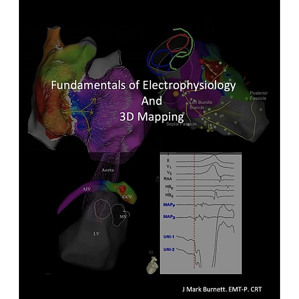Fundamentals of Electrophysiology and 3D Mapping, J Mark Burnett
