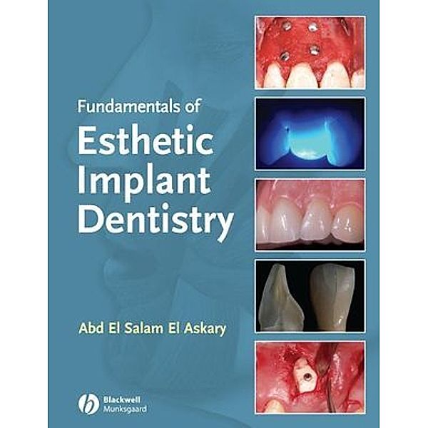 Fundamentals of Esthetic Implant Dentistry, Abd El Salam El Askary