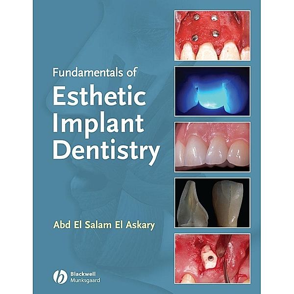 Fundamentals of Esthetic Implant Dentistry, Abdelsalam Elaskary