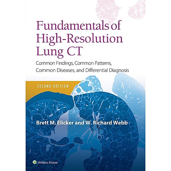 Fundamentals of High-Resolution Lung CT, Brett M. Elicker, W. Richard Webb