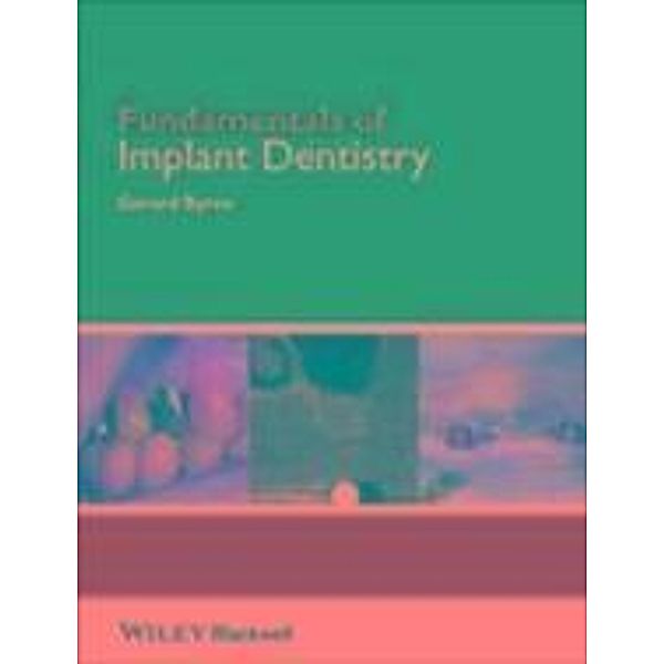 Fundamentals of Implant Dentistry / Fundamentals (Dentistry), Gerard Byrne