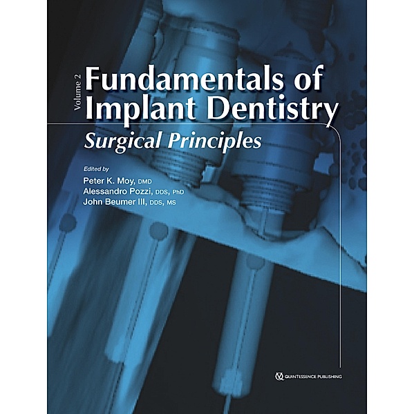 Fundamentals of Implant Dentistry, Volume II / Volume Bd.2, Peter K Moy, Alessandro Pozzi, John III Beumer