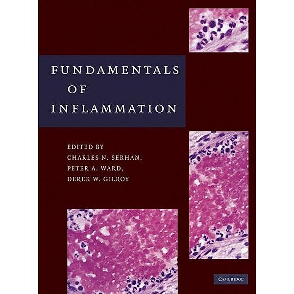 Fundamentals of Inflammation