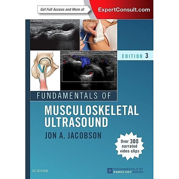 Fundamentals of Musculoskeletal Ultrasound, Jon A. Jacobson