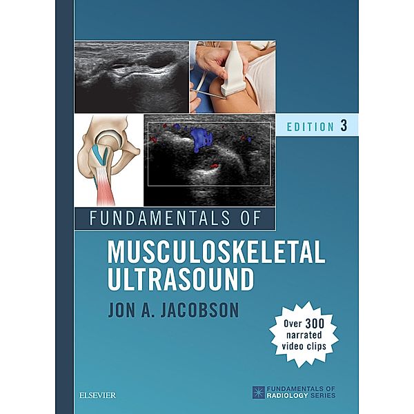 Fundamentals of Musculoskeletal Ultrasound E-Book, Jon A. Jacobson