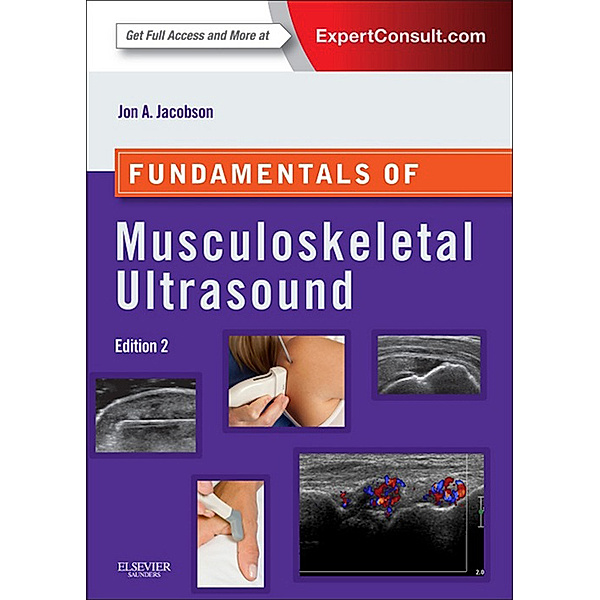 Fundamentals of Radiology: Fundamentals of Musculoskeletal Ultrasound E-Book, Jon A. Jacobson
