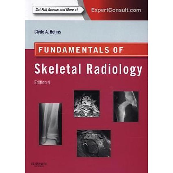 Fundamentals of Skeletal Radiology, Clyde A. Helms