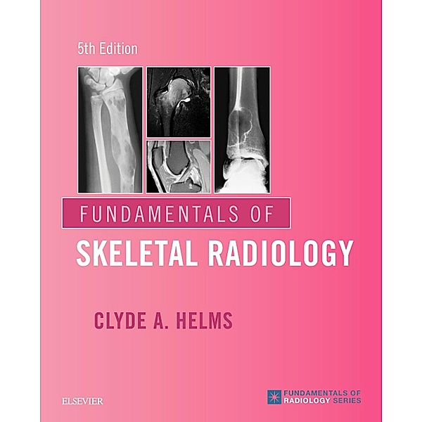 Fundamentals of Skeletal Radiology E-Book, Clyde A. Helms