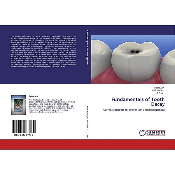 Fundamentals of Tooth Decay, REETA JAIN, Ravi Shankar, G. C. Jain