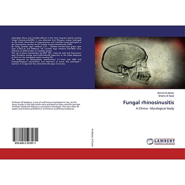 Fungal rhinosinusitis, Ahmed Al abbasi, Shams Al Saad