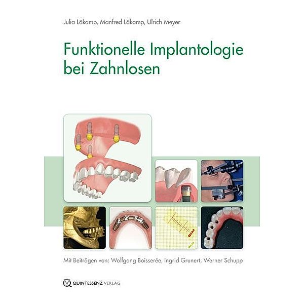 Funktionelle Implantologie, Julia Läkamp, Manfred Läkamp, Ulrich Meyer