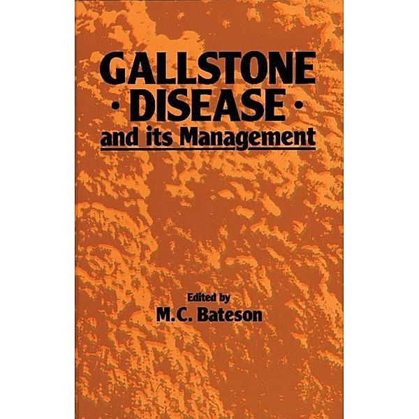 Gallstone Disease and its Management