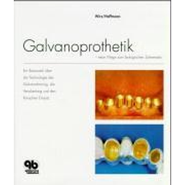 Galvanoprothetik, Jakob Wirz, Andreas Hoffmann