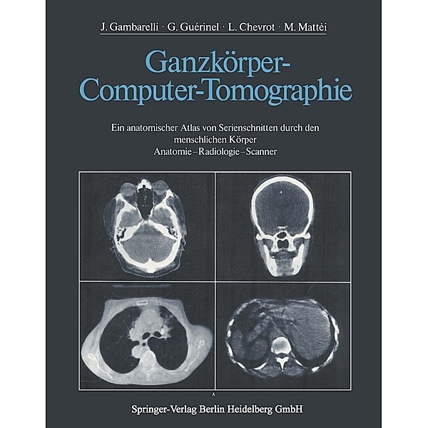 Ganzkörper-Computer-Tomographie, J. Gambarelli, G. Guerinel, L. Chevrot, M. Mattei