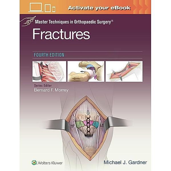 Gardner: Master Techniques in Orthopaedic Surgery: Fractures, Michael J. Gardner